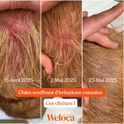 Cure Démangeaisons - Weloca